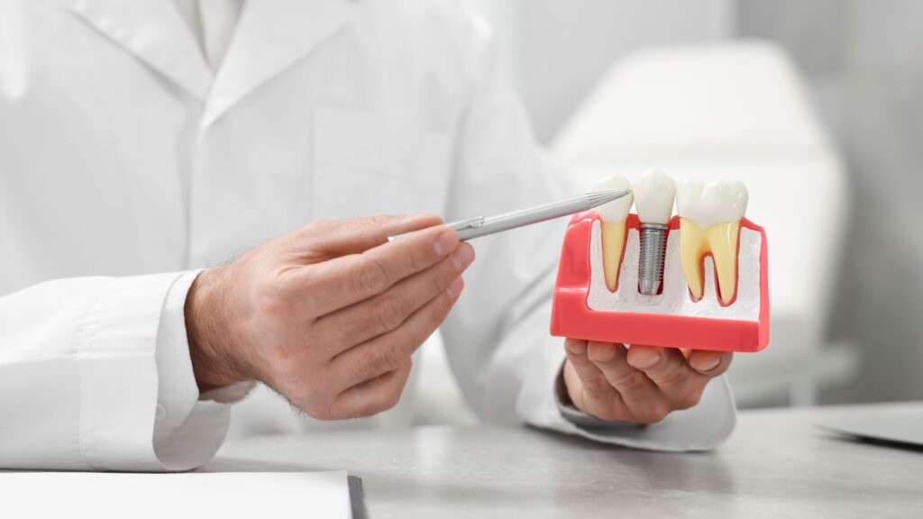 How to Get Dental Implants Covered by Medical Insurance: 10 Proven Ways 